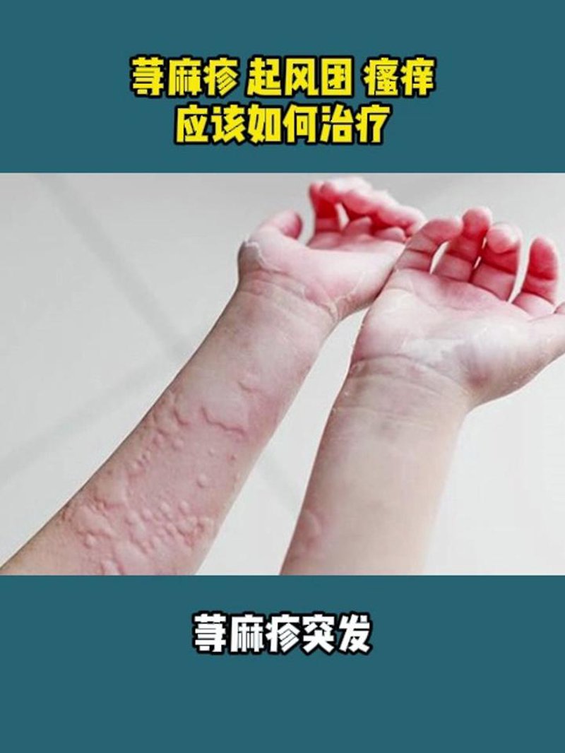 渭南皮肤病医院:揭开皮肤问题的神秘面纱