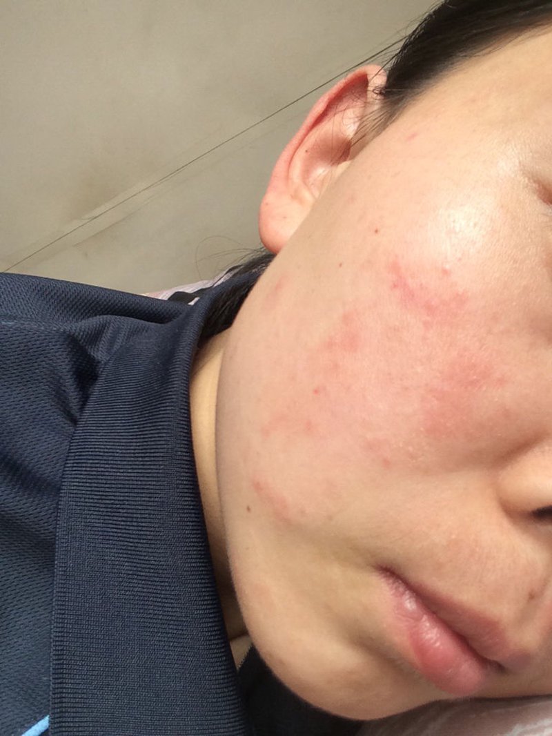 渭南皮肤病医院:引领城市皮肤健康守护之光