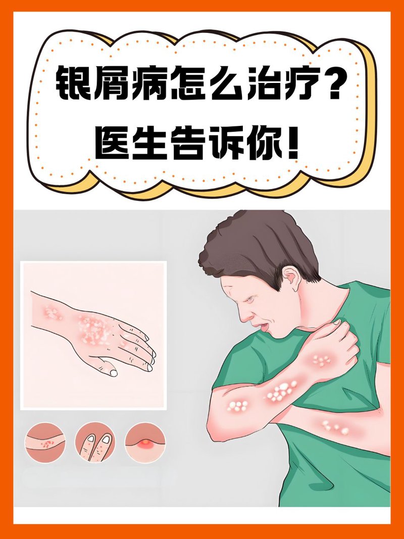 渭南皮肤病医院:关注健康的温馨港湾