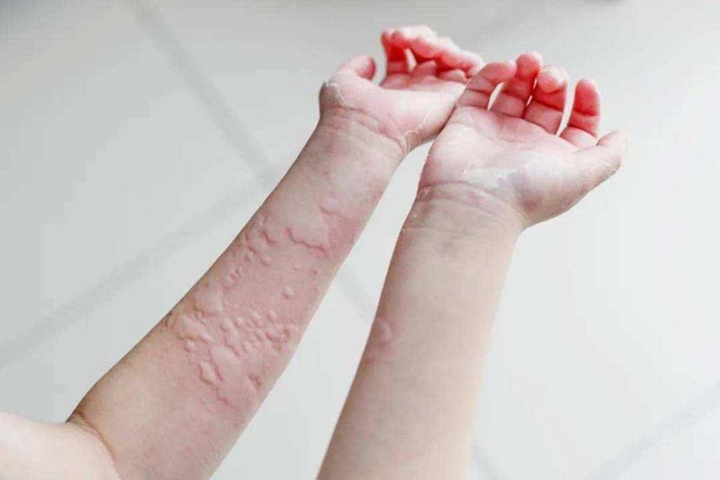 渭南皮肤病医院:面对肌肤困扰的最佳选择