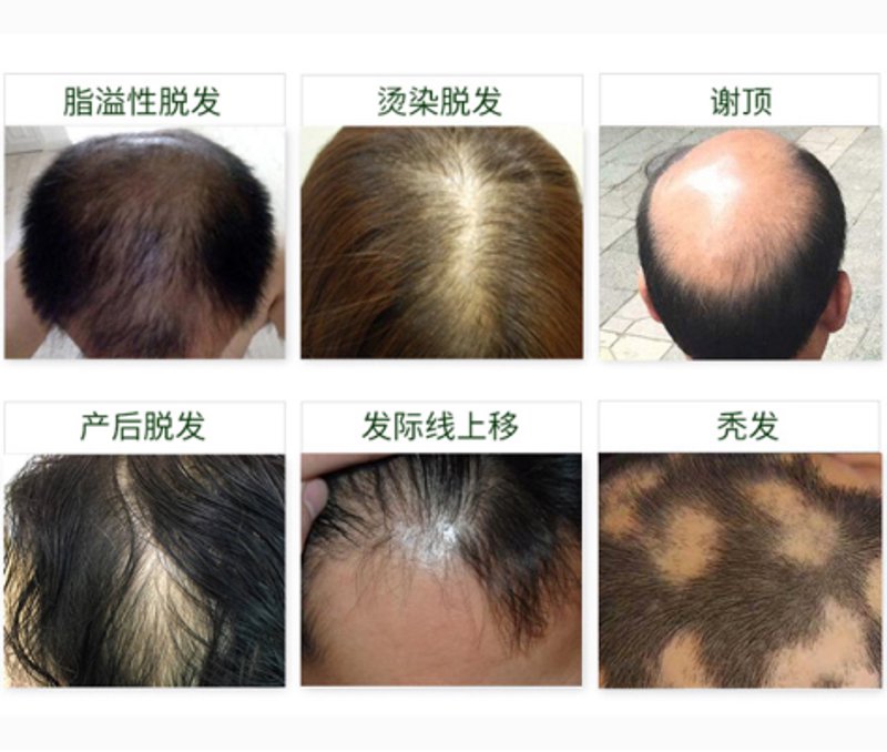 皮肤问题困扰你的生活?海成皮肤医院为您解析行业动态