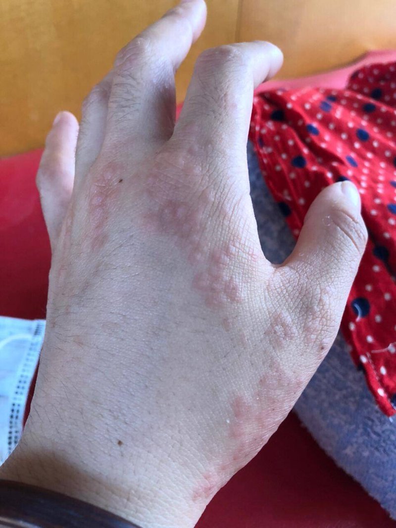 渭南皮肤病医院:为健康保驾护航